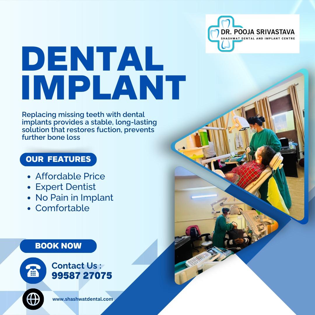 Dental Implant Process